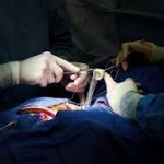 heart_surgery